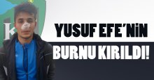 Yusuf Efe Yaman’ın burnu kırıldı!