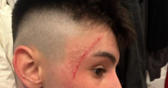 Kartepe Belediyespor’da 4 futbolcu yaralandı